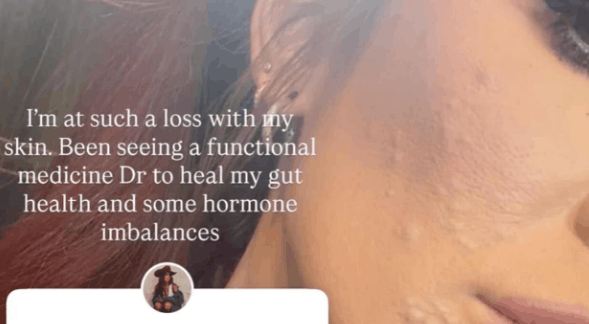 Fans Notice Something In Chelsea’s Photo