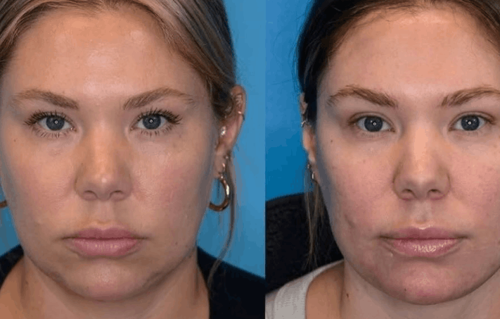 Kailyn’s Update