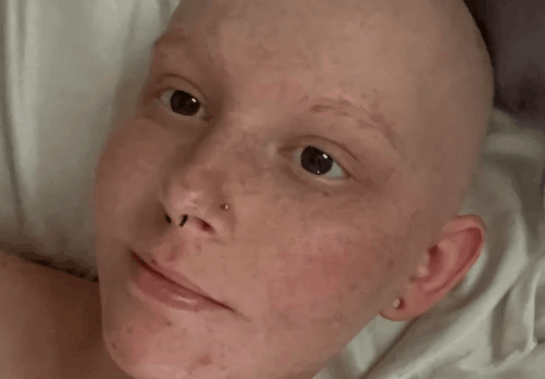 Woman Shares Before & After Photos